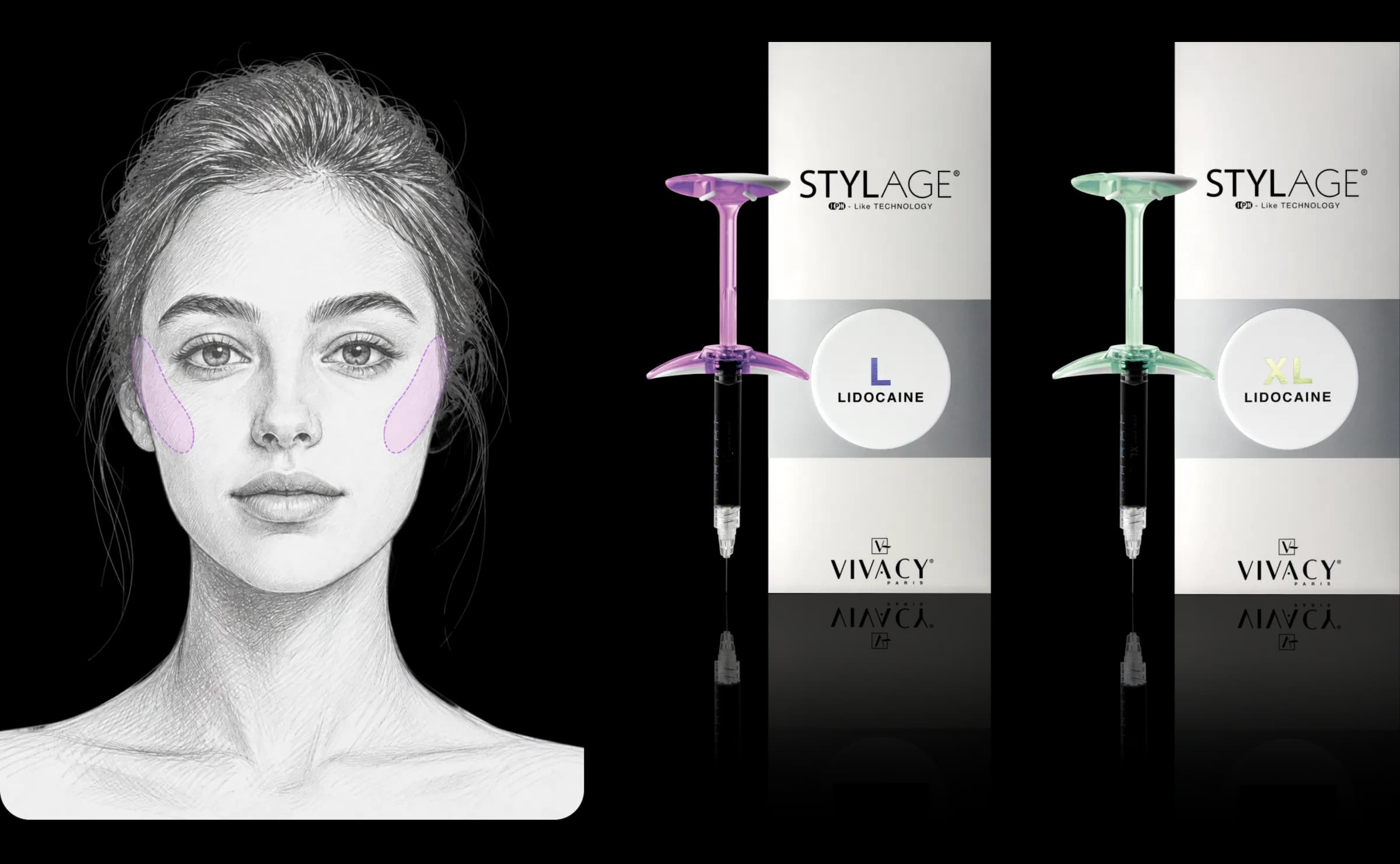 STYLAGE® L Lido 시술 가이드