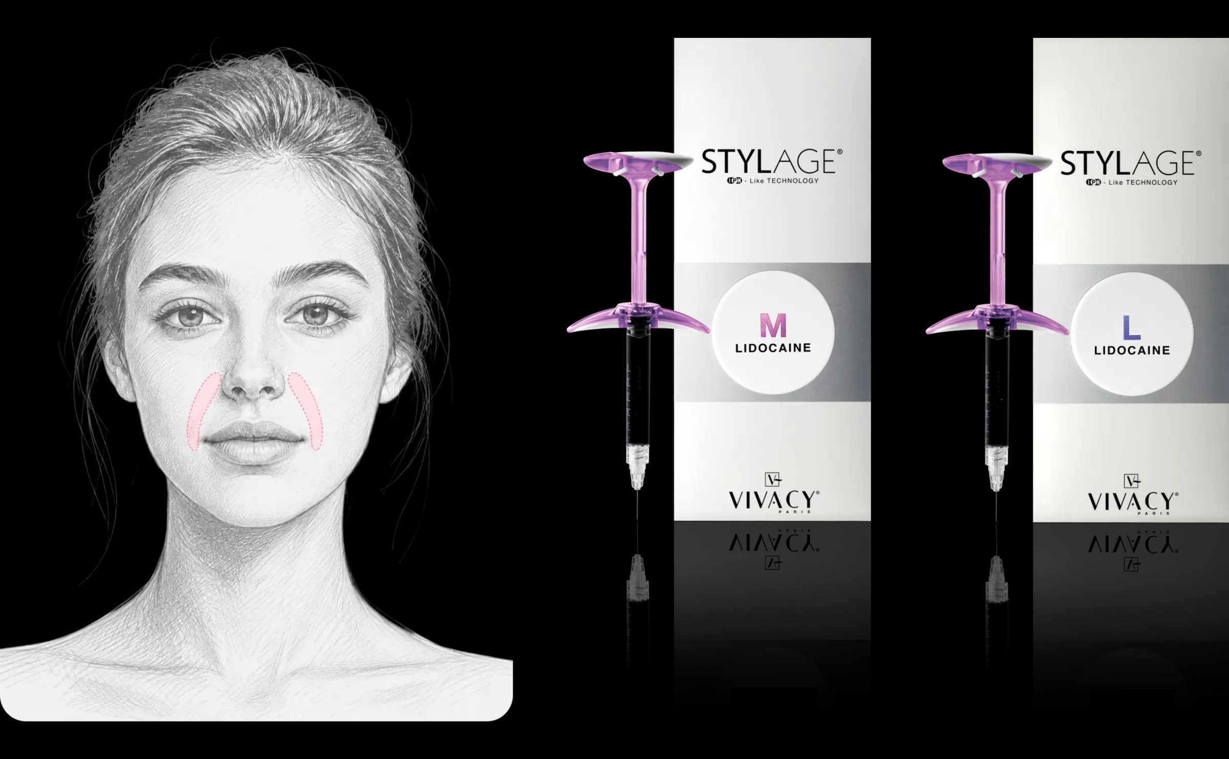 STYLAGE® M Lido 시술 가이드