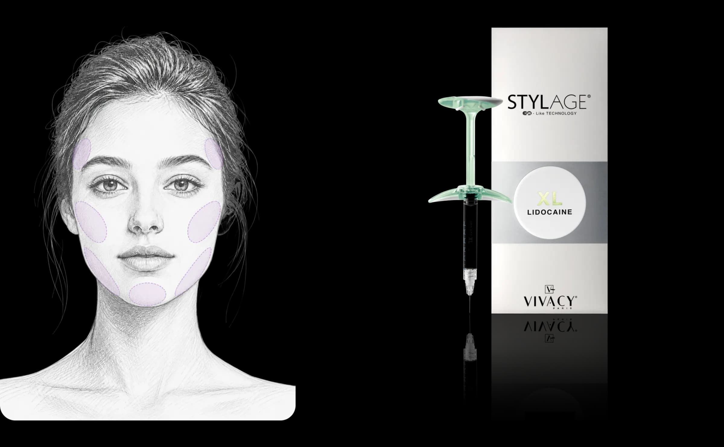 STYLAGE® XL Lido 시술 가이드